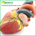 HEART11 (12487) nouveau modèle d&#39;anatomie de coeur de taille de 4xlife d&#39;Oversize séparé en 4-parts